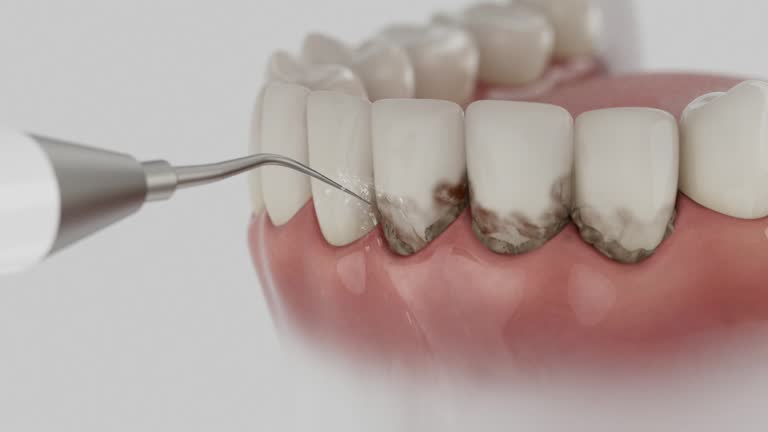 Reliable Dental Implants contractor in Wolf Trap, VA by Smile Center Dentistry